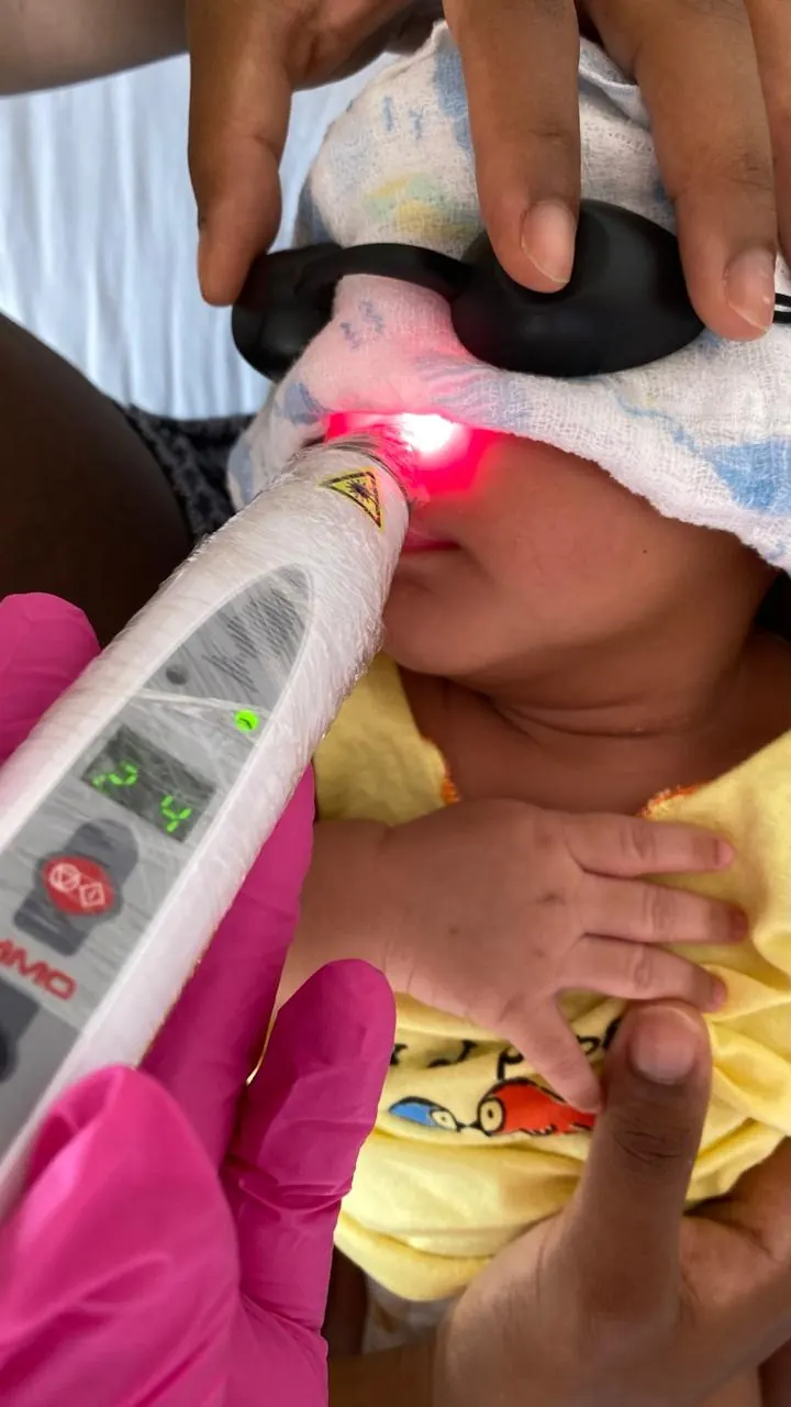 Aplicação de laserterapia com luz de baixa intensidade em bebê