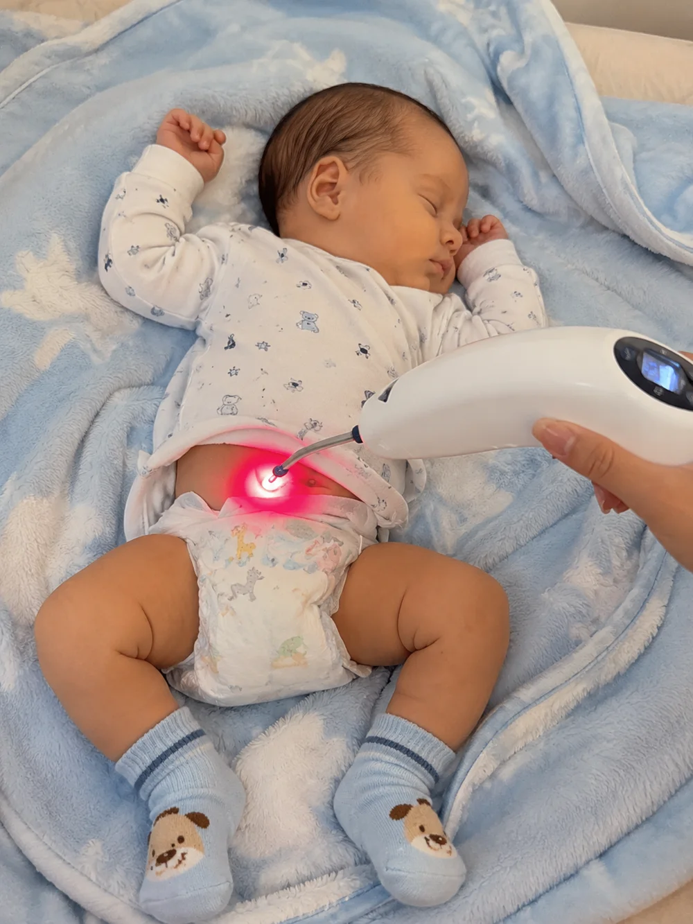 Bebê recebendo aplicação segura de laserterapia pediátrica